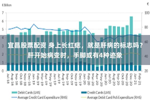 宜昌股票配资 身上长红痣，就是肝病的标志吗？肝开始病变时，手脚或有4种迹象